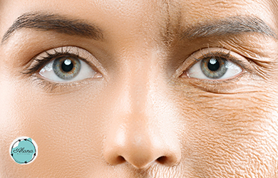 Tratamiento de rejuvenecimiento facial con microdermoabrasión con