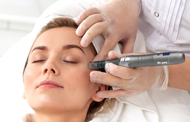 Tratamiento Facial de Microneedling con Vitamina C