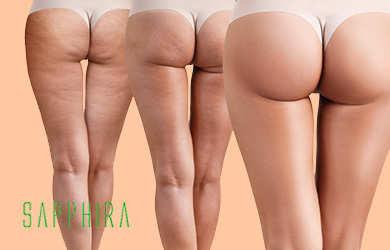 Tratamiento Ultrareductor de Piernas: vacumterapia, radiofrecuenc