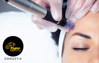 Tratamiento facial con Dermapen